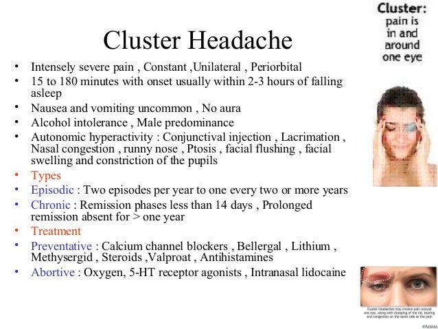 Headache during pregnancy Headache during pregnancy