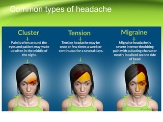 Common types of headache
 