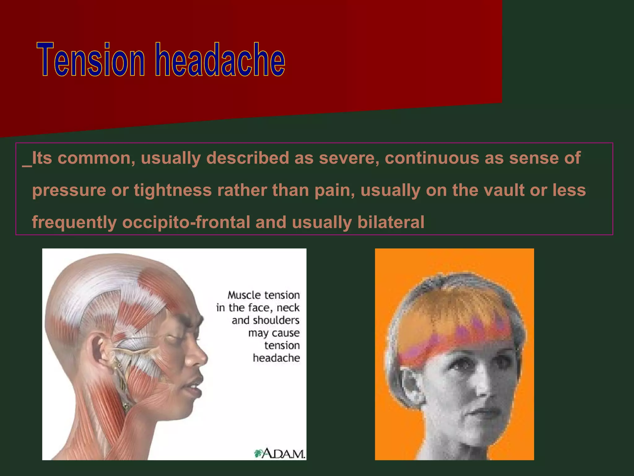 Tension headache _Its common, usually described as severe, continuous as sense of pressure or tightness rather than pain, usually on the vault or less frequently occipito-frontal and usually bilateral  