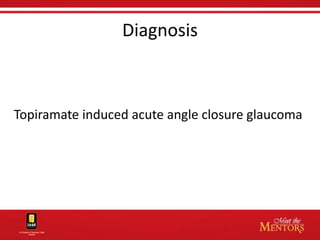 Diagnosis



Topiramate induced acute angle closure glaucoma
 