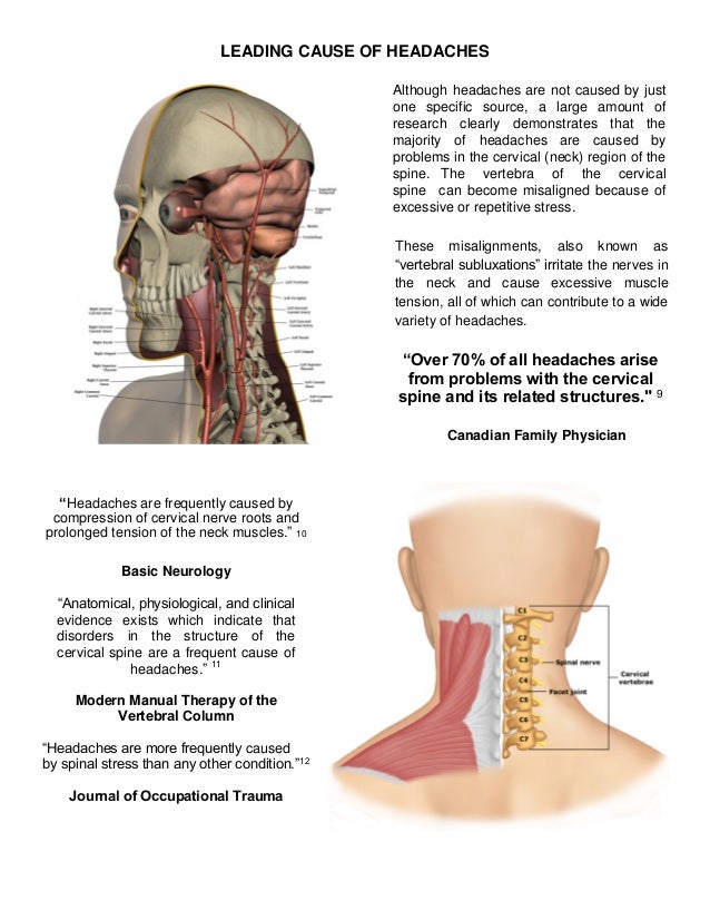 Headaches and Chiropractic