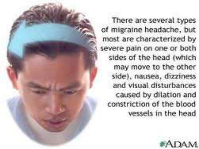 Image result for causes for severe headaches