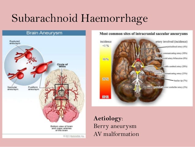 Headaches for the amk Headaches for the amk