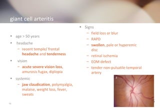 giant cell arteritis 
• age > 50 years 
• headache 
– recent temple/ frontal 
headache and tenderness 
• vision 
– acute severe vision loss, 
amurosis fugax, diplopia 
• systemic 
– jaw claudication, polymyalgia, 
malaise, weight loss, fever, 
sweats 
• Signs 
– field loss or blur 
– RAPD 
– swollen, pale or hyperemic 
disc 
– retinal ischemia 
– EOM defect 
– tender non-pulsatile temporal 
artery 
10 
 