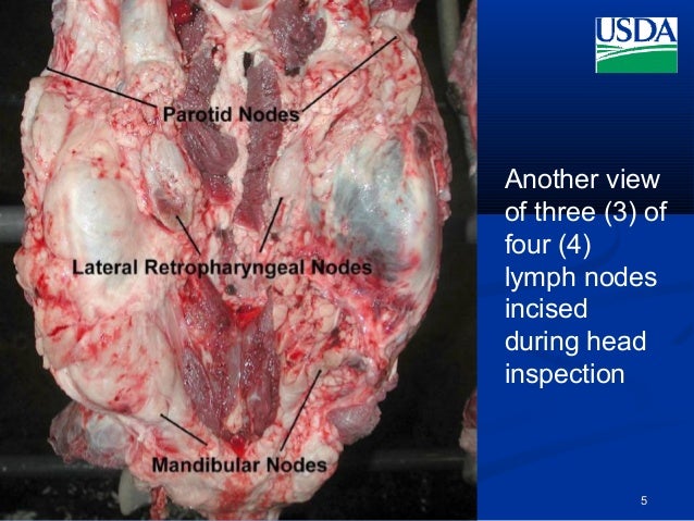 Head anatomy& lymph nodes