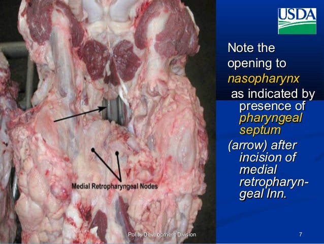 Head anatomy& lymph nodes