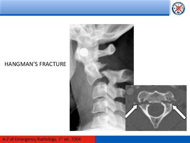Head and cervical spine imaging