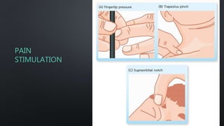 PAIN
STIMULATION
 