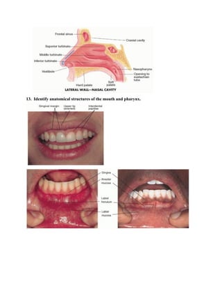 13. Identify anatomical structures of the mouth and pharynx.
 
