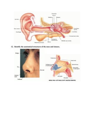 12. Identify the anatomical structures of the nose and sinuses.
 