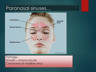 Paranasal sinuses…
Patholgy :
Sinusitis – chronic/acute
Carcinoma of maxillary sinus
 