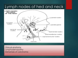 Lymph nodes of hed and neck
Clinical anatomy
Lymphadenopathy
Metastasis of carcinoma
 