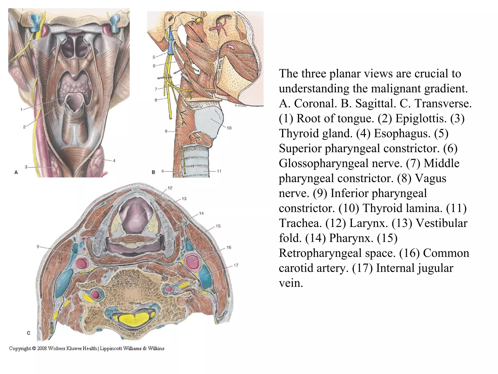 Head And Neck Cancer | PPT