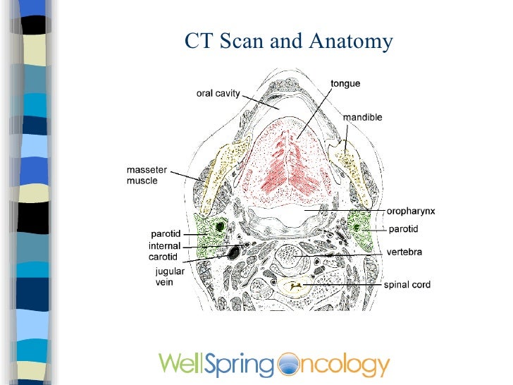 Ct Scan Head And Neck Anatomy Ct Scan Machine