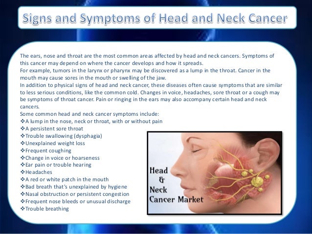 Understanding Head And Neck Cancer Symptoms Causes Ri Vrogue Co Understanding Head And Neck Cancer Symptoms Causes Ri Vrogue Co