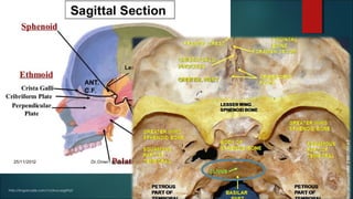 http://imgarcade.com/1/clivus-sagittal/
 