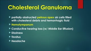 Cholesterol Granuloma
 partially obstructed petrous apex air cells filled
with cholesterol debris and hemorrhagic fluid
 Hemotympanum
 Conductive hearing loss (w/ Middle Ear Effusion)
 Dizziness
 Tinnitus
 Headache
 