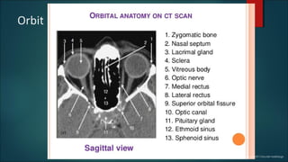 Orbit
https://www.slideshare.net/vijayjoshi311/ocular-radiology
 