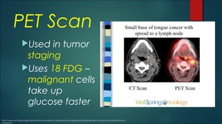 PET Scan
Used in tumor
staging
Uses 18 FDG –
malignant cells
take up
glucose faster
http://www.enttoday.org/article/clinicians-question-usefulness-of-multiple-post-treatment-petct-scans-for-head-and-neck-
cancer/2/
 
