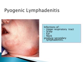 Infections of :
 Upper respiratory tract
 Scalp
 Ear
 Neck
produce secondary
lymphadenitis.
 