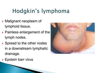  Malignant neoplasm of
lymphoid tissue.
 Painless enlargement of the
lymph nodes.
 Spread to the other nodes
in a downstream lymphatic
drainage.
 Epstein barr virus
 