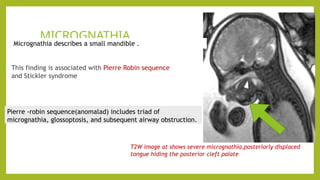 head and neck masses power point presentation | PPTX