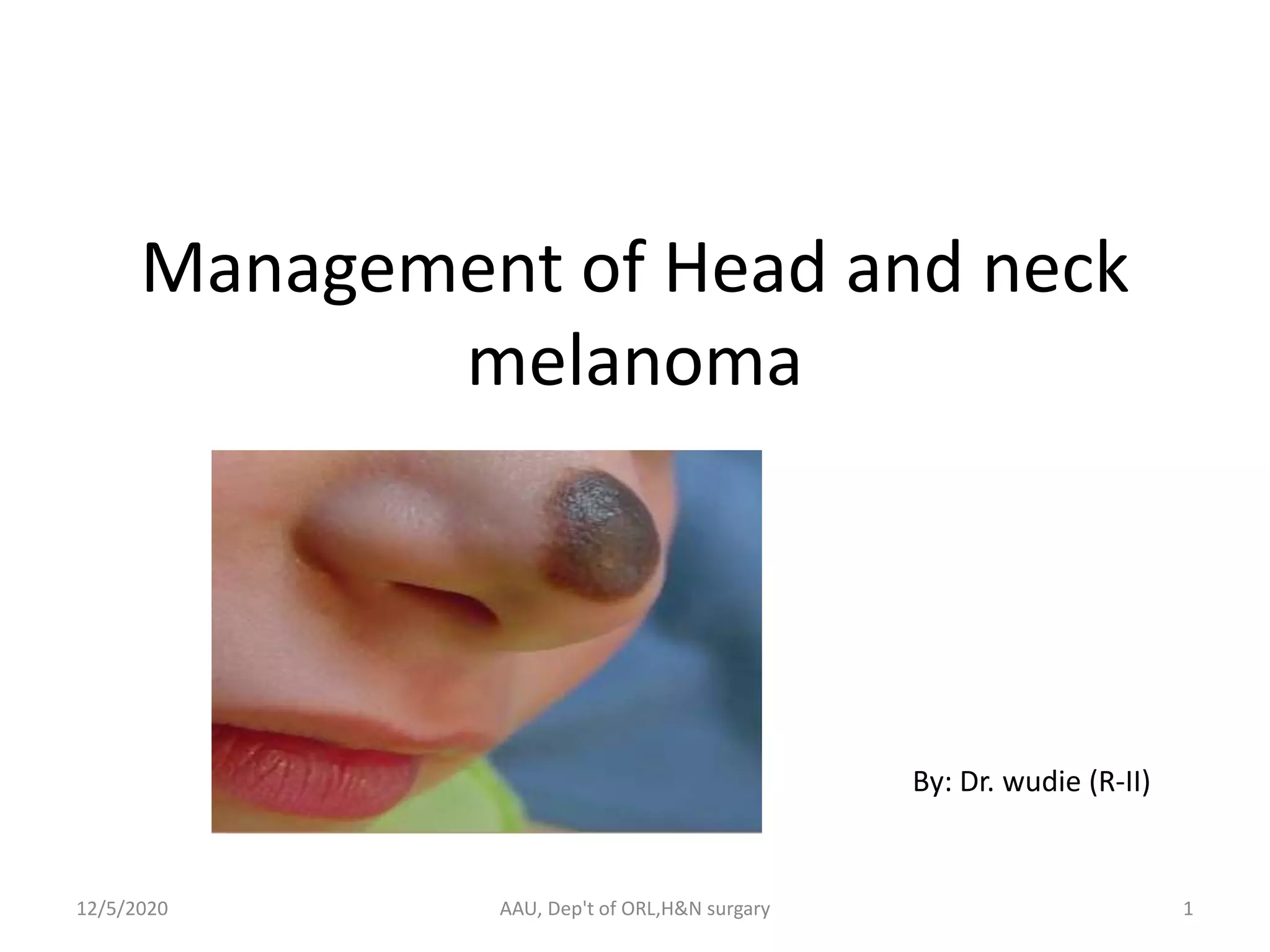 Head and neck melanoma | PPTX