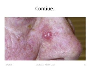 Head and neck melanoma | PPTX