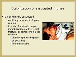 Stabilization of associated injuries
• C-spine injury suspected
– Avoid any movement of spinal
column
– Establish & maintain proper
immobilization until vertebral
fractures or spinal cord injuries
ruled out
• Lateral C-spine radiographs
• CT of C-spine
• Neurologic exam
 