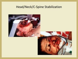 Head/Neck/C-Spine Stabilization
 