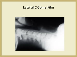 Lateral C-Spine Film
 