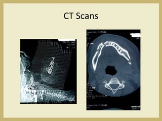 CT Scans
 