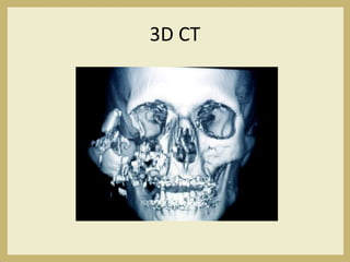 3D CT
 