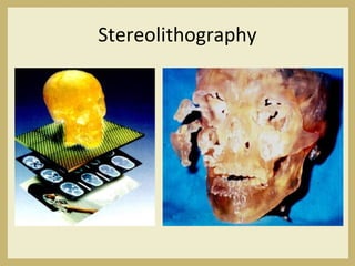 Stereolithography
 
