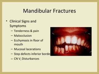 Mandibular Fractures
• Clinical Signs and
Symptoms
– Tenderness & pain
– Malocclusion
– Ecchymosis in floor of
mouth
– Mucosal lacerations
– Step defects inferior border
– CN V3 Disturbances
 