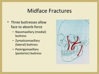 Midface Fractures
• Three buttresses allow
face to absorb force
– Nasomaxillary (medial)
buttress
– Zymaticomaxillary
(lateral) buttress
– Pyterigomaxillary
(posterior) buttress
 