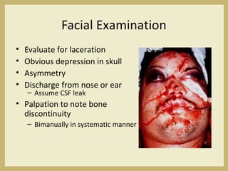 Facial Examination
• Evaluate for laceration
• Obvious depression in skull
• Asymmetry
• Discharge from nose or ear
– Assume CSF leak
• Palpation to note bone
discontinuity
– Bimanually in systematic manner
 