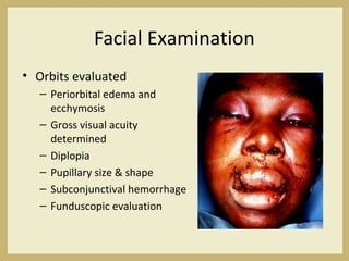 Facial Examination
• Orbits evaluated
– Periorbital edema and
ecchymosis
– Gross visual acuity
determined
– Diplopia
– Pupillary size & shape
– Subconjunctival hemorrhage
– Funduscopic evaluation
 