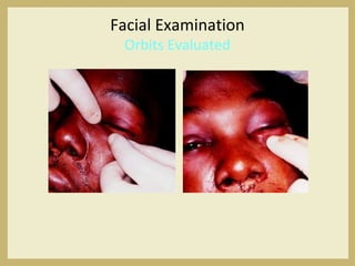Facial Examination
Orbits Evaluated
 