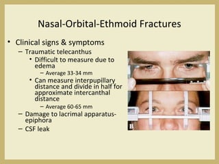 Nasal-Orbital-Ethmoid Fractures
• Clinical signs & symptoms
– Traumatic telecanthus
• Difficult to measure due to
edema
– Average 33-34 mm
• Can measure interpupillary
distance and divide in half for
approximate intercanthal
distance
– Average 60-65 mm
– Damage to lacrimal apparatus-
epiphora
– CSF leak
 