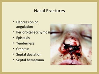 Nasal Fractures
• Depression or
angulation
• Periorbital ecchymosis
• Epistaxis
• Tenderness
• Crepitus
• Septal deviation
• Septal hematoma
 