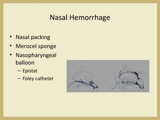 Nasal Hemorrhage
• Nasal packing
• Merocel sponge
• Nasopharyngeal
balloon
– Epistat
– Foley catheter
 