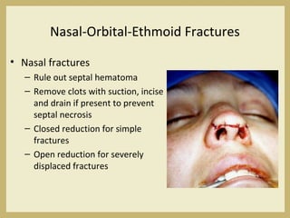 Nasal-Orbital-Ethmoid Fractures
• Nasal fractures
– Rule out septal hematoma
– Remove clots with suction, incise
and drain if present to prevent
septal necrosis
– Closed reduction for simple
fractures
– Open reduction for severely
displaced fractures
 