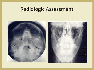 Radiologic Assessment
 