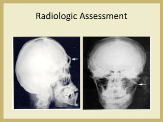 Radiologic Assessment
 