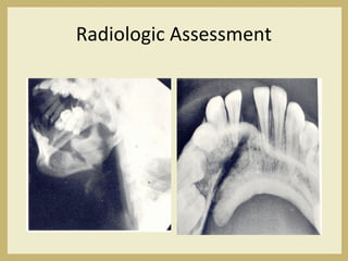 Radiologic Assessment
 