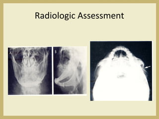 Radiologic Assessment
 