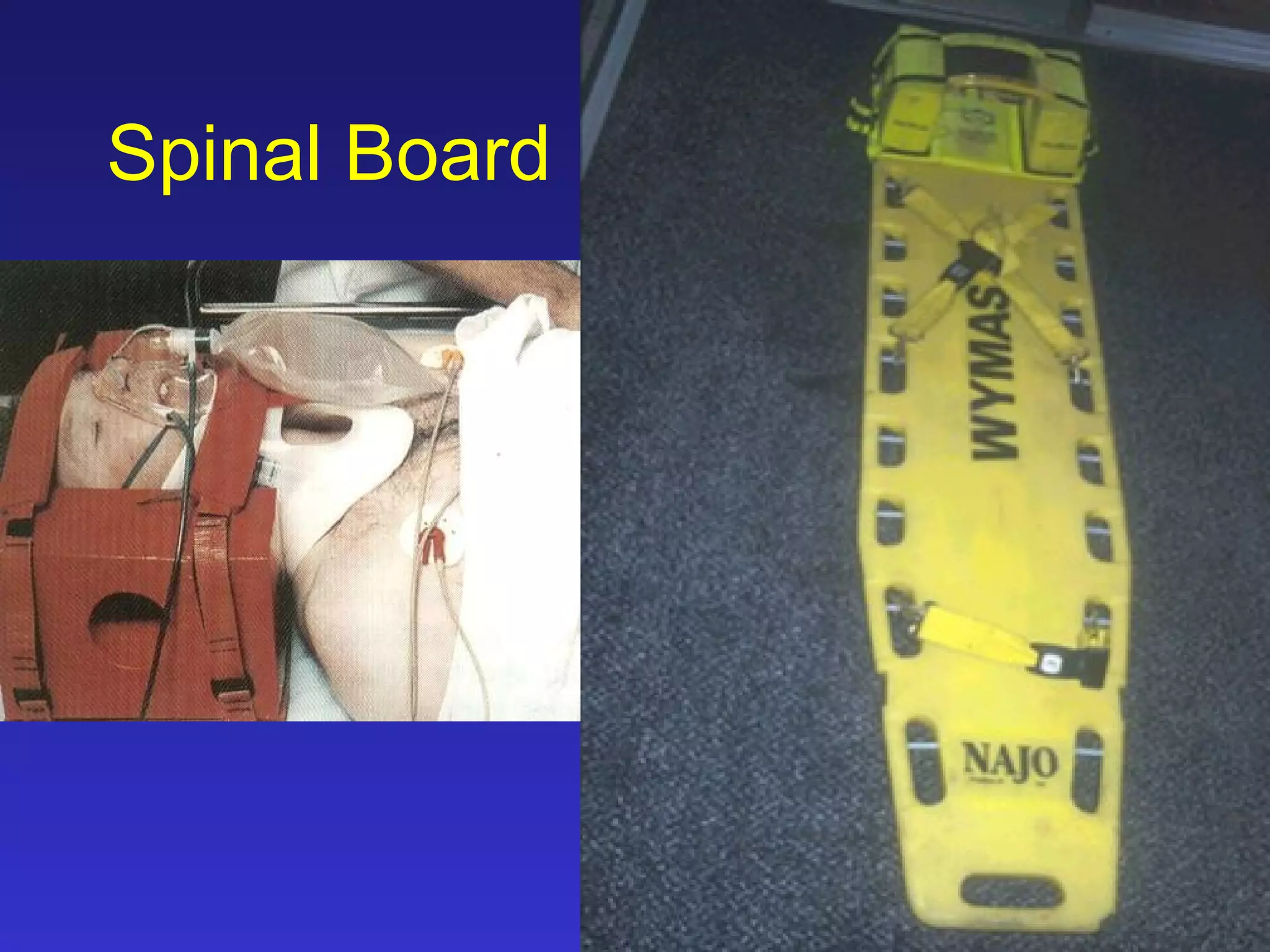 Spinal Board 