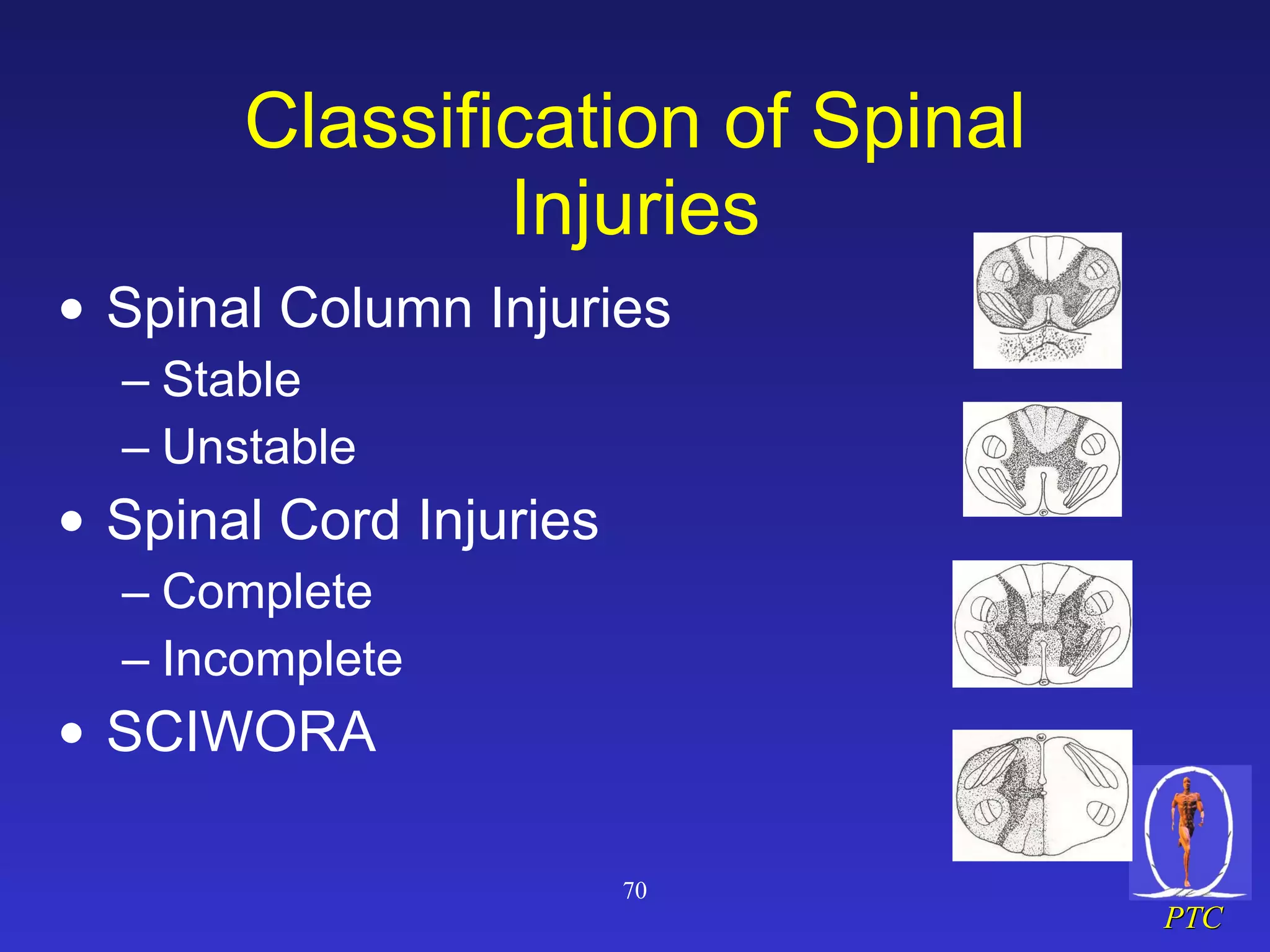 Classification of Spinal Injuries Spinal Column Injuries Stable Unstable Spinal Cord Injuries Complete Incomplete SCIWORA 