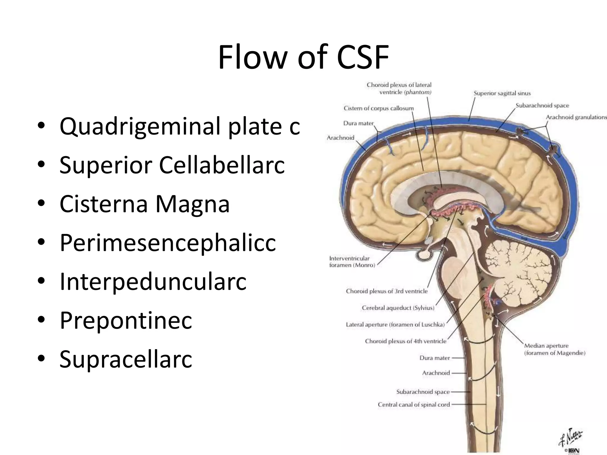 Flow of CSFQuadrigeminal plate cSuperior CellabellarcCisterna MagnaPerimesencephaliccInterpeduncularcPrepontinecSupracellarc